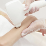 Best Laser Hair Removal Services in Potomac MD